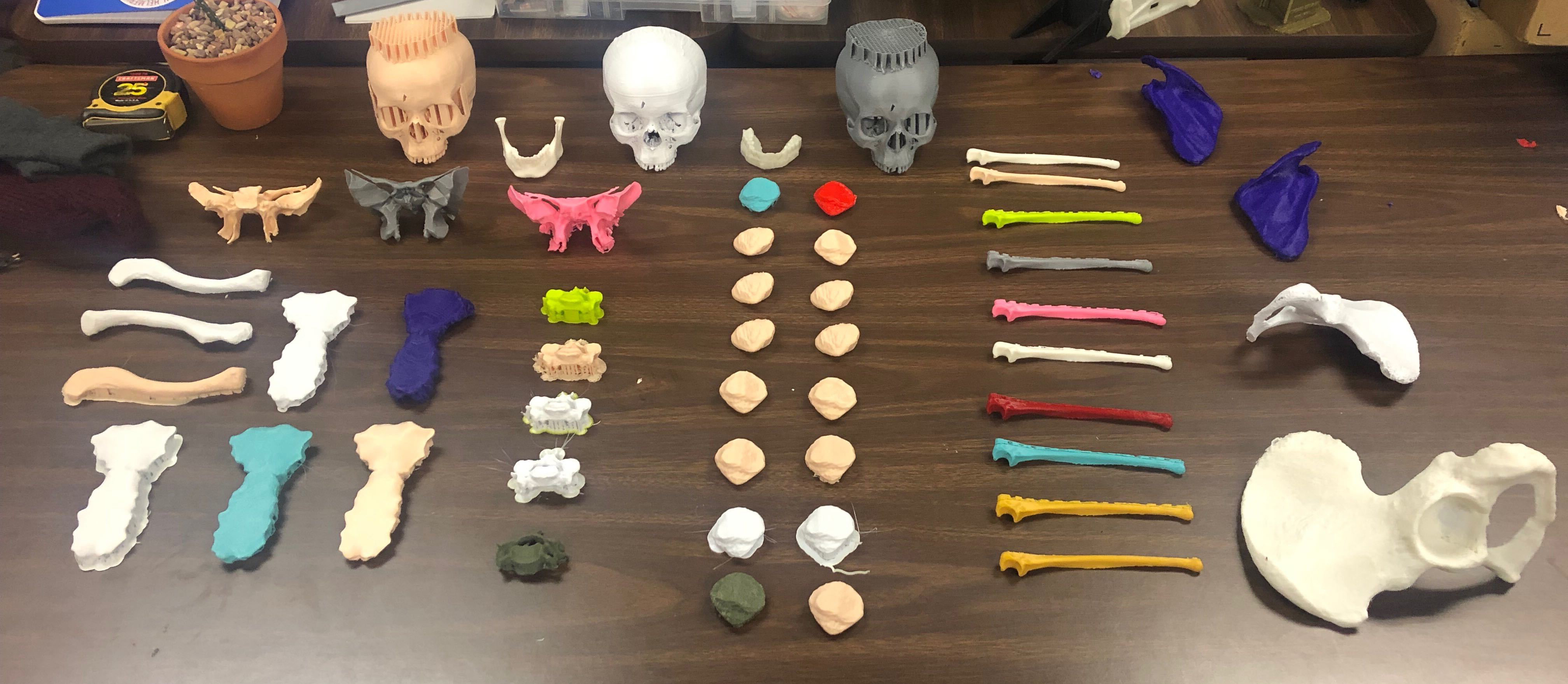 Photo of 3D Printed Bones